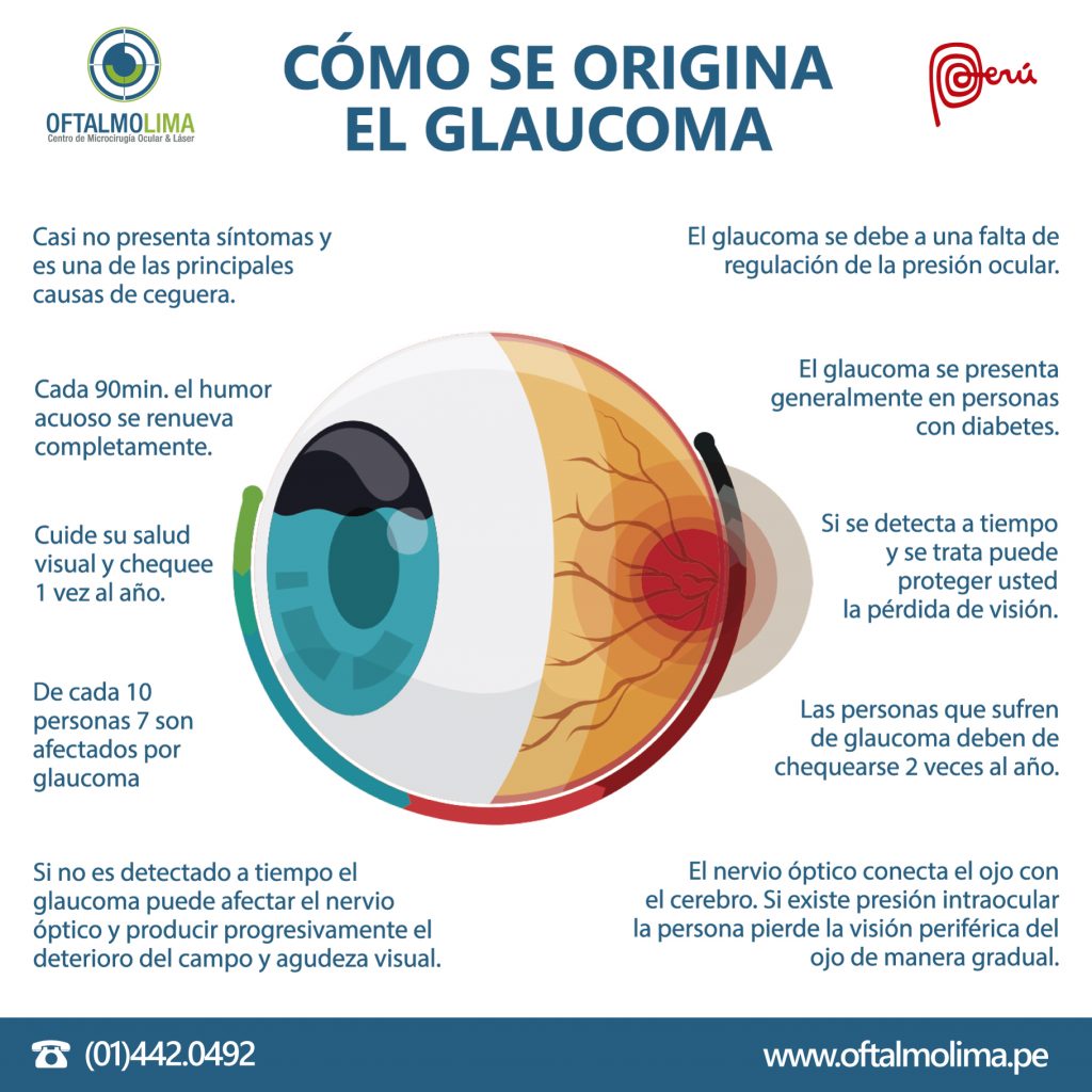 CÓmo Se Origina El Glaucoma Oftalmolima 9842
