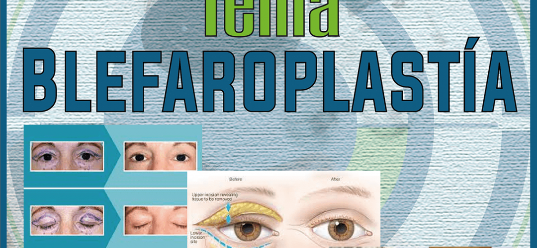 oftalmolima-que-es-la-blefaroplastia